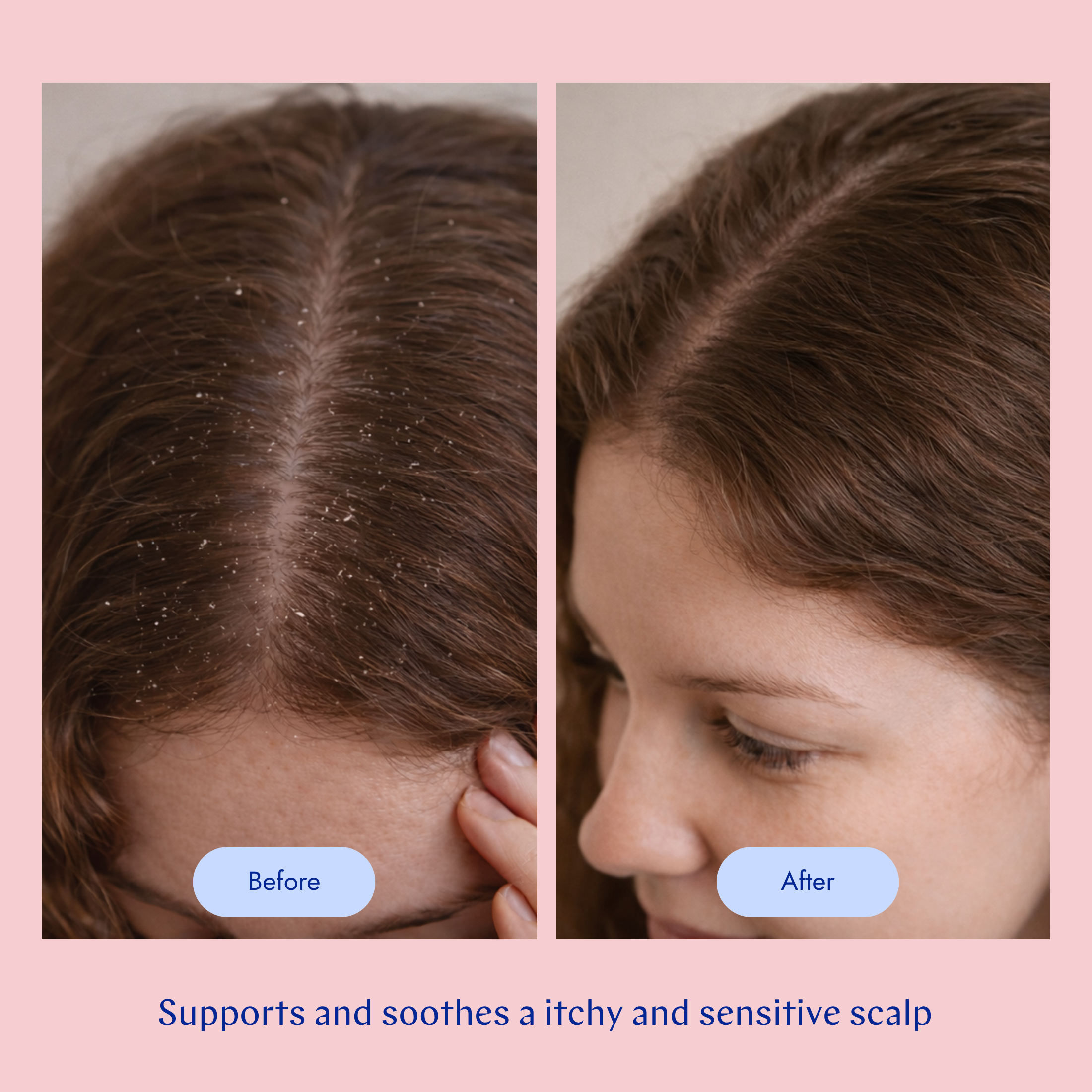 Scalp Care Shampoo